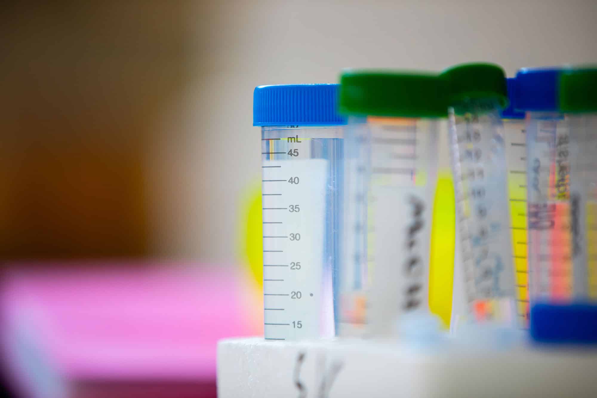 test tubes in a lab